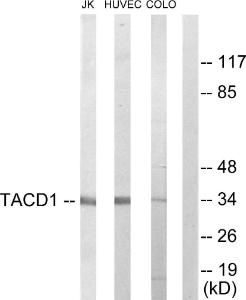 Western blot analysis of lysates from Jurkat, HUVEC, and COLO205 cells using Anti-TACD1 Antibody. The right hand lane represents a negative control, where the antibody is blocked by the immunising peptide