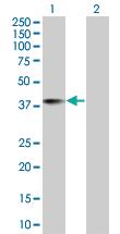 Anti-TSNAXIP1 Mouse Polyclonal Antibody