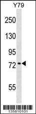 Anti-KATNB1 Rabbit Polyclonal Antibody (APC (Allophycocyanin))