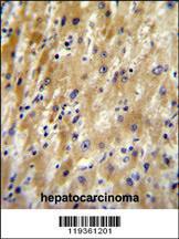 Anti-HABP2 Rabbit Polyclonal Antibody