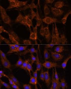 Immunofluorescence analysis of C6 cells using Anti-Peregrin/BRPF1 Antibody (A93180) at a dilution of 1:100. DAPI was used to stain the cell nuclei (blue)