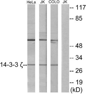 Western blot analysis of lysates from HeLa, Jurkat, and COLO cells using Anti-14-3-3 zeta Antibody. The right hand lane represents a negative control, where the Antibody is blocked by the immunising peptide