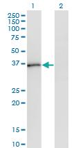 Anti-PQBP1 Mouse Monoclonal Antibody [clone: 1A11]