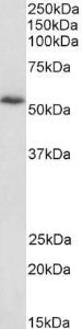 Anti-DBNL antibody