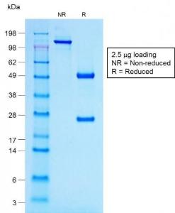 SDS-PAGE analysis of Anti-ACTH Antibody [r57] under non-reduced and reduced conditions; showing intact IgG and intact heavy and light chains, respectively. SDS-PAGE analysis confirms the integrity and purity of the Antibody