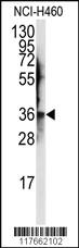 Anti-AIMP2 Rabbit Polyclonal Antibody