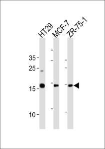 Anti-AGR2 Rabbit Polyclonal Antibody (Biotin)