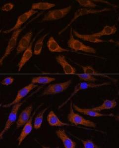 Immunofluorescence analysis of L929 cells using Anti-Peregrin/BRPF1 Antibody (A93180) at a dilution of 1:100. DAPI was used to stain the cell nuclei (blue)