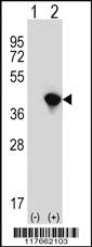 Anti-AIMP2 Rabbit Polyclonal Antibody