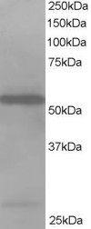 Anti-DBNL antibody