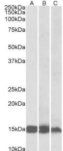 Anti-FABP3 Antibody (A85112) (0.01 µg/ml) staining of Human (A), Mouse (B) and Rat(C) Heart lysates (35 µg protein in RIPA buffer). Primary incubation was 1 hour. Detected by chemiluminescence