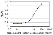 Anti-PQBP1 Mouse Monoclonal Antibody [clone: 1A11]