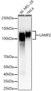 Western blot analysis of various lysates, using Anti-LAMP2 Antibody (A8983) at 1:2,000 dilution. The secondary antibody was Goat Anti-Rabbit IgG H&L Antibody (HRP) at 1:10,000 dilution.