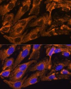 Immunofluorescence analysis of U-2 OS cells using Anti-Peregrin/BRPF1 Antibody (A93180) at a dilution of 1:100. DAPI was used to stain the cell nuclei (blue)