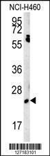 Anti-EBPL Rabbit Polyclonal Antibody (HRP (Horseradish Peroxidase))