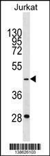 Anti-GTF3A Rabbit Polyclonal Antibody (Biotin)