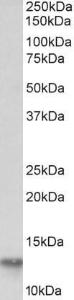 Anti-FABP4 Antibody (A85113) (0.03µg/ml) staining of Human Adipose lysate (35µg protein in RIPA buffer). Primary incubation was 1 hour. Detected by chemiluminescence.