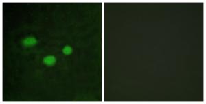 Antibody anti-DNMT3B A98383-100 100 µg