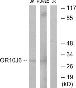 Western blot analysis of lysates from Jurkat and HUVEC cells using Anti-OR10J6 Antibody The right hand lane represents a negative control, where the antibody is blocked by the immunising peptide