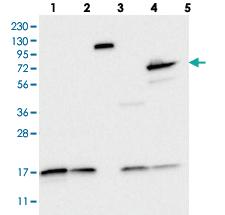 Anti-SLC28A3 Rabbit Polyclonal Antibody