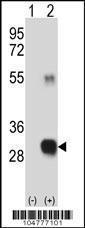 Anti-RCE1 Rabbit Polyclonal Antibody (FITC (Fluorescein))