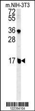 Anti-BLOC1S2 Rabbit Polyclonal Antibody (Biotin)