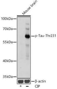 Anti-Tau (phospho Thr231) Rabbit Polyclonal Antibody