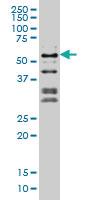 Anti-NFIC Mouse Monoclonal Antibody [clone: 1D6]