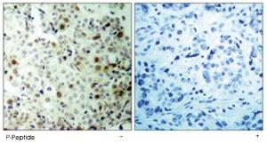 Anti-CDK2 Rabbit Polyclonal Antibody