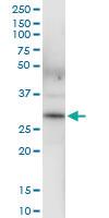 Anti-BDH1 Polyclonal Antibody Pair