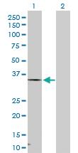 Anti-HSD17B7 Rabbit Polyclonal Antibody