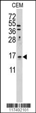 Anti-LSM1 Rabbit Polyclonal Antibody