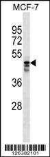 Anti-MUDEN Rabbit Polyclonal Antibody (HRP (Horseradish Peroxidase))