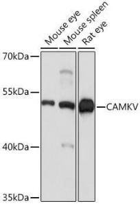 Anti-CAMKV antibody