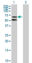 Anti-ALB Rabbit Polyclonal Antibody