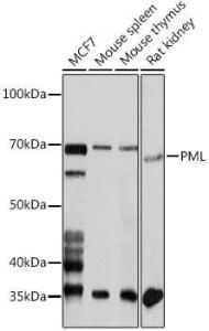 Western blot analysis of extracts of various cell lines, using Anti-PML Protein Antibody (A309121) at 1:1,000 dilution The secondary antibody was Goat Anti-Rabbit IgG H&L Antibody (HRP) at 1:10,000 dilution Lysates/proteins were present at 25 µg per lane