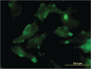 Anti-HSD17B7 Mouse Monoclonal Antibody [clone: 1G10]