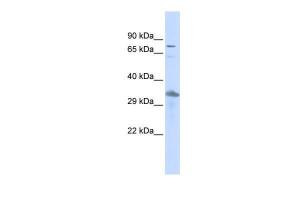 Anti-TEF Rabbit Polyclonal Antibody