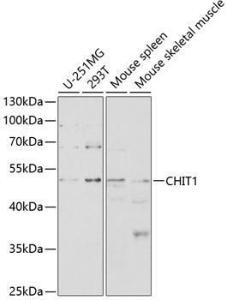 Western blot analysis of extracts of various cell lines, using Anti-CHIT1 Antibody (A8987) at 1:1,000 dilution. The secondary antibody was Goat Anti-Rabbit IgG H&L Antibody (HRP) at 1:10,000 dilution.