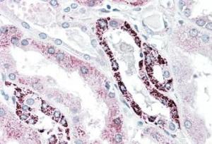 Anti-PLK3 Antibody (A85115) (5 µg/ml) staining of paraffin embedded Human Kidney. Steamed antigen retrieval with citrate buffer pH 6, AP-staining