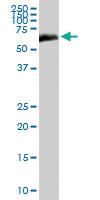 Anti-ALB Rabbit Polyclonal Antibody