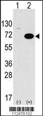 Anti-STK39 Rabbit Polyclonal Antibody (AP (Alkaline Phosphatase))