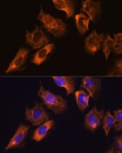 Anti-CAMKV antibody