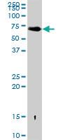 Anti-ALB Rabbit Polyclonal Antibody