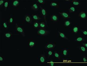 Anti-NFIC Mouse Monoclonal Antibody [clone: 1D6]