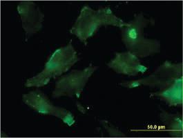 Anti-HSD17B7 Mouse Monoclonal Antibody [clone: 1G10]