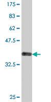 Anti-RPP14 Mouse Polyclonal Antibody