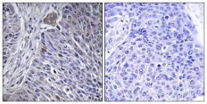 Antibody anti-HNRPDL 100 µg