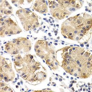 Immunohistochemistry analysis of paraffin-embedded human normal stomach using Anti-CHIT1 Antibody (A8987) at a dilution of 1:200 (40x lens)