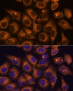 Anti-CAMKV antibody